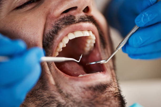 Best Emergency Dentist for Knocked-Out Tooth in Sylvania, AL
